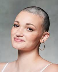 13 people with the most striking eyes in the world. From Alopecia And Birthmarks To Debilitating Skin Conditions Three Women Learned To Love Themselves