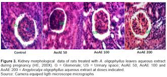 Image result for Angylocalyx