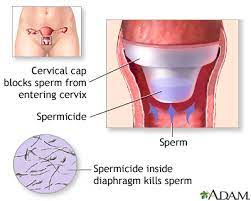 Spermicide Sexual Health