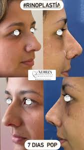 Nelson Ortiz Zarate (@dr.nelsonortiz) • Instagram photos and videos