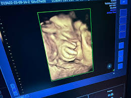 Image result for tbn:T5UajvfpShvp6M::www.photoslinks.com/index.php%3Foption%3Dcom_joomgallery%26func%3Dwatermark%26catid%3D4%26id%3D23%26Itemid%3D2