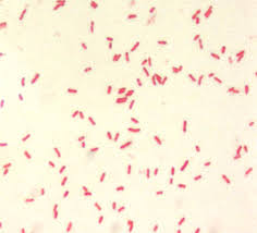 Free picture: yersinia pestis, small, gram, negative, bacillus