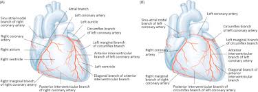 If a ramus intermedius artery is present, the diagonal arteries are. Coronary Arteries And Heart Sciencedirect