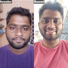 1_Year_Transformation From Getting teased by the people to taking me as an  inspiration I have made it in this year of journey Upon seeing the  transformation by Anaam Ali I got inspired