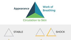Image result for Pediatric Assessment Triangle