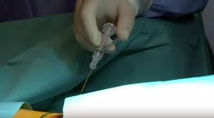 Cat si cu ajutorul operatilor cu laser. Hernie De Disc Tratata Fara Bisturiu Cat Costa Aceasta Operatie