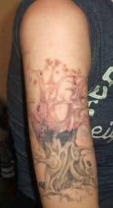 My Experience Lightening And Removing My Tattoo At Home Tatring Tattoos Piercings