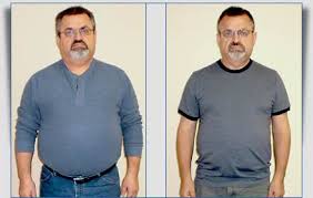 weight loss with cpap machine