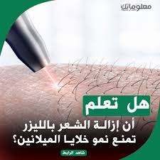 هل تعلم أن إزالة الشعر بالليزر تمنع نمو خلايا الميلانين