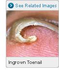 Nail disorders in cats come in a variety of forms and from several different causes. Ingrown Toenails Symptoms Causes Treatment And Prevention