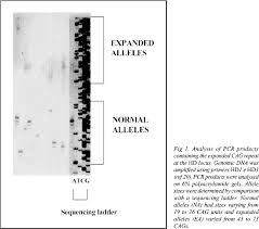 Scielo Brasil Molecular Diagnosis Of Huntington Disease In Brazilian Patients Molecular Diagnosis Of Huntington Disease In Brazilian Patients