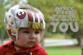 X Wing Fighter Helmet Star Wars Cranial Band Doc Helmet Https Www Facebook Com Pages Cranial Bandsmur Baby Helmet Baby Helmet Design Boys Baby Helmet Design