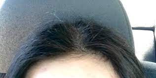 Eat eggs and poultry for protein, your hair is protein so it requires it to grow. Looking For Advice On How To Tame The Chronic Fly Aways On The Top Of My Head The Rest Of My Hair Is Not Fri Fly Away Hair How To Tame