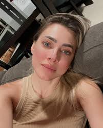 Y así va quedando mi piel después de una sesión de Lumeca, la mejor luz  pulsada, que me va a ayudar a mi rosácea, quitando lo rojo, cerrando vasos  sanguíneos, unificar tono