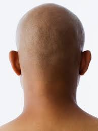 5.4 hair growth outside the treatment area there is the potential for hair growth to occur in areas where latisse® solution comes in repeated contact with the skin surface. Why Are Bald Guys Using Latisse Allure