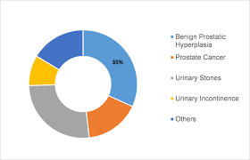 Urology Devices Market Research Report Forecast To 2023 Mrfr