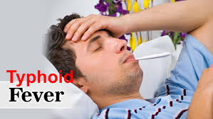 It mostly affects people in developing countries, where sanitation is poor and getting clean water is a problem. Typhoid Fever Causes Symptoms Prevention Vaccine Diagnosis Treatment