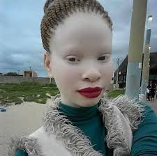 Oneil Robinson funy...