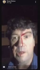 Casey Holmes convicted of assaulting man in viral video