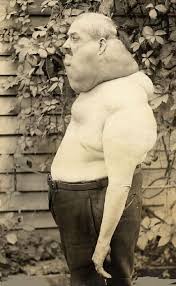 Old Creepy Photos Deformed Man Lazer Horse Human Oddities Creepy Old Photos Creepy Photos