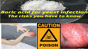 Is Boric Acid Safe Can It Cure Yeast Infections Caution Boric Acid Poisoning D N Medical Series Youtube