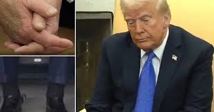 Trump "sick"?/ White House spokeswoman reacts - BOTA