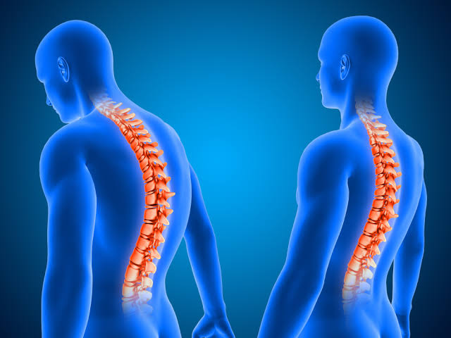 Posture correction