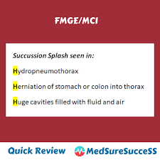 Image result for Succussion Splash