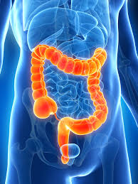 Large Intestine Diseases | Colonic Diseases | MedlinePlus