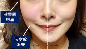 A 艹 (grass) radical was added to 頻 to make its meaning more apparent. æå‡è˜‹æžœè‚Œ è˜‹æžœè‚Œä¸‹åž‚å¾µç‹€ä½ è¦çŸ¥ 3å€‹æ–¹æ³•æ‰¾å›žé£½æ»¿è˜‹æžœè‚Œ
