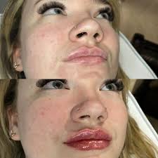 Alison Eames, RPN (@beginagainmed) · Bowmanville, ON