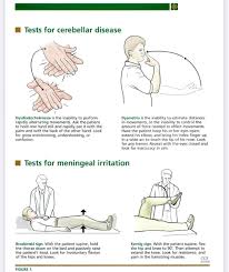 Image result for Rapid Alternating Movements