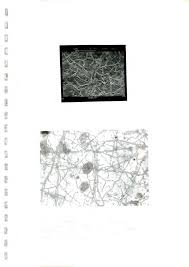 Image result for Combretum xanthothyrsum