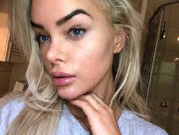 Det er også fordeler avhengig av typen pille. Sophie Elise Acne I Voksen Alder