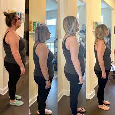 By restricting food absorbtion and reducing hunger the gastric sleeve might be your best option. Bariatric Patient Testimonials Prime Surgicare