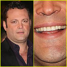 This can make sneezing fits worse, and it can be plain gross. Vince Vaughn Nose Hairs Gone Wild Vince Vaughn Just Jared