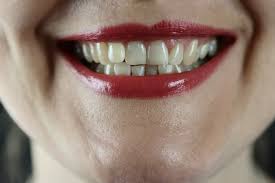 Alibaba.com offers 1,229 lipstick mouth products. 100 Teeth Pictures Download Free Images Stock Photos On Unsplash