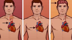 For example, a heart attack is more common among men aged 45 to 55. Do You Really Know The Difference Between A Heart Attack A Cardiac Arrest And A Stroke Neopress