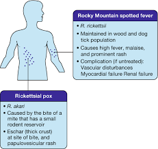 Image result for Rickettsialpox