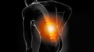 Osteochondrose Ursachen Symptome Diagnostik Schon Klinik