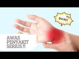 Kesemutan adalah kondisi di mana anggota tubuh mengalami sensasi panas, geli, atau kebas yang dibarengi jika sudah demikian, kesemutan bisa menjadi tanda adanya penyakit. Tangan Kebas Tanda Penyakit Apa Tangan Selalu Kebas Ia Mungkin Tanda Bagi 5 Penyakit Ini No 4 Punca Paling Lazim