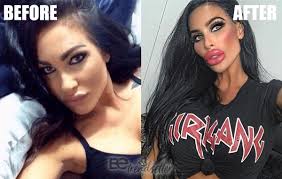 Ray liotta before and after plastic surgery. Plastic Surgery Gone Wrong 31 Worst Celebrity Before And After