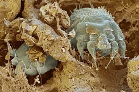Image result for human scabies