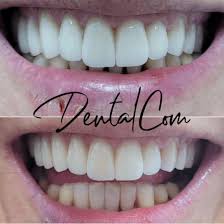 Dentalcom -Odontología Estética-