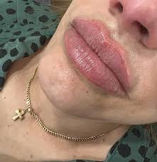 Meilani Aesthetics• (@meilani_aesthetics) · Instagram 照片和视频