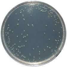 This formula conforms to clinical and laboratory standard institute (clsi). Pp3131 Mueller Hinton Agar With 2 Sodium Chloride 25ml E O Laboratories Ltd