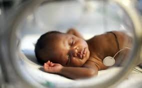 Some problems may be apparent at birth, while others may not develop until later. A Weekly Look At Premature Babies And Complications