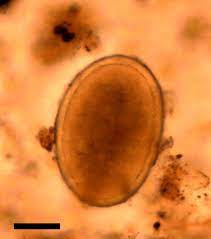 Decorticated Roundworm Egg Ascaris Lumbricoides From Sacral Sample Download Scientific Diagram