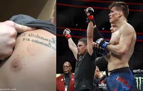 Diego sanchez is an american professional mixed martial artist with a background in wrestling and gaidojutsu, system of submission wrestling developed by his longtime trainer greg jackson. Did Mickey Gall Try To Bite His Way Through Diego Sanchez To Avoid Loss