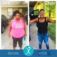But the reality is much harder than it sounds. Gastric Sleeve Before And After Photos The Best Pictures Of 2020
